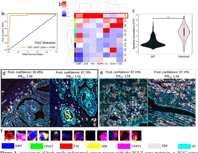 Figure 4 for NaroNet: Discovery of tumor microenvironment elements from highly multiplexed images