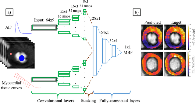 Figure 1 for Deep learning-based prediction of kinetic parameters from myocardial perfusion MRI