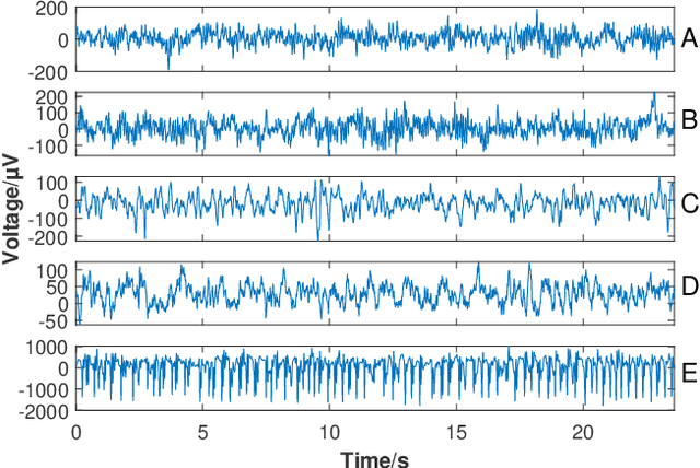 Figure 1 for Significant Low-dimensional Spectral-temporal Features for Seizure Detection