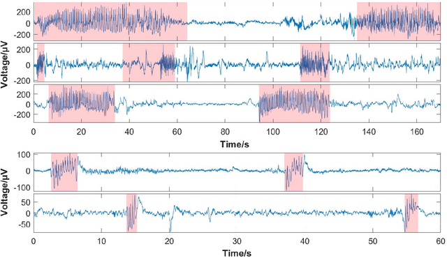 Figure 2 for Significant Low-dimensional Spectral-temporal Features for Seizure Detection