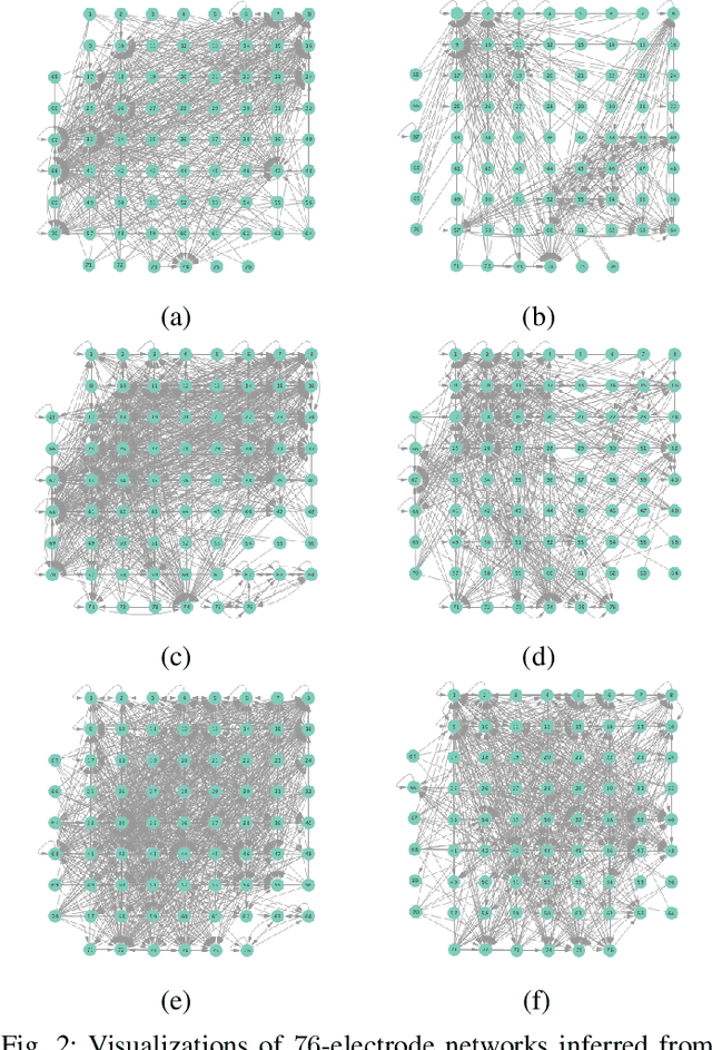 Figure 2 for Nonlinear Structural Vector Autoregressive Models for Inferring Effective Brain Network Connectivity