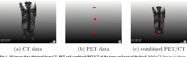 Figure 1 for Exploit fully automatic low-level segmented PET data for training high-level deep learning algorithms for the corresponding CT data