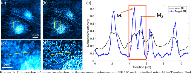 Figure 1 for Deep learning-based super-resolution fluorescence microscopy on small datasets