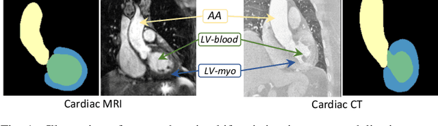 Figure 1 for PnP-AdaNet: Plug-and-Play Adversarial Domain Adaptation Network with a Benchmark at Cross-modality Cardiac Segmentation