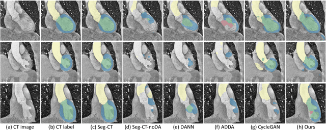 Figure 3 for PnP-AdaNet: Plug-and-Play Adversarial Domain Adaptation Network with a Benchmark at Cross-modality Cardiac Segmentation