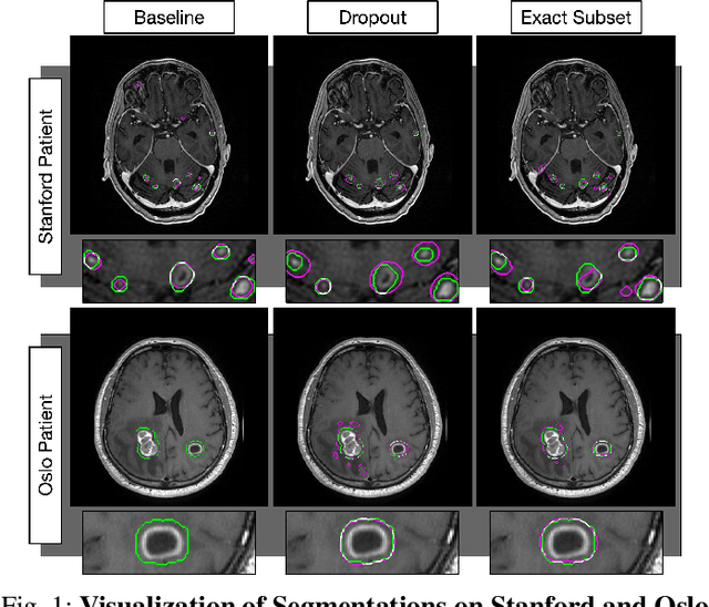 Figure 1 for MRI Pulse Sequence Integration for Deep-Learning Based Brain Metastasis Segmentation