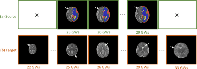 Figure 1 for Tissue Segmentation of Thick-Slice Fetal Brain MR Scans with Guidance from High-Quality Isotropic Volumes