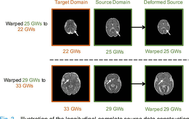 Figure 3 for Tissue Segmentation of Thick-Slice Fetal Brain MR Scans with Guidance from High-Quality Isotropic Volumes