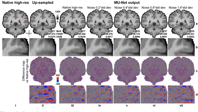 Figure 2 for SRNR: Training neural networks for Super-Resolution MRI using Noisy high-resolution Reference data