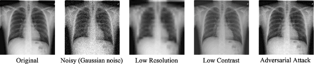 Figure 1 for Improving Robustness and Reliability in Medical Image Classification with Latent-Guided Diffusion and Nested-Ensembles