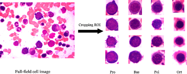 Figure 2 for Shape-Aware Fine-Grained Classification of Erythroid Cells