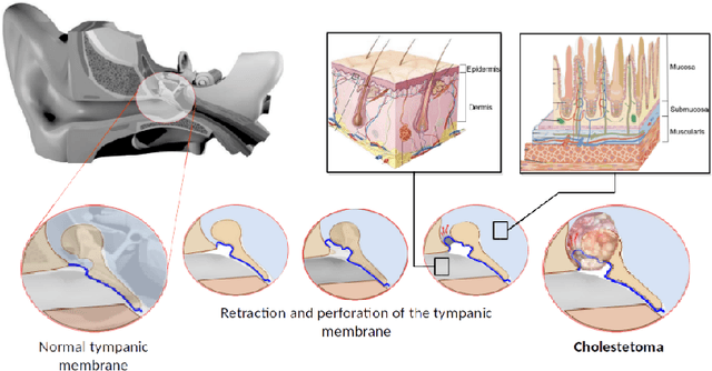 Figure 1 for Safe Path following for Middle Ear Surgery