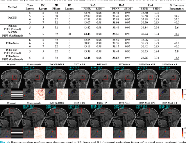 Figure 4 for PhaseNet: Phase-Encode Denoising Network for Compressed Sensing MRI