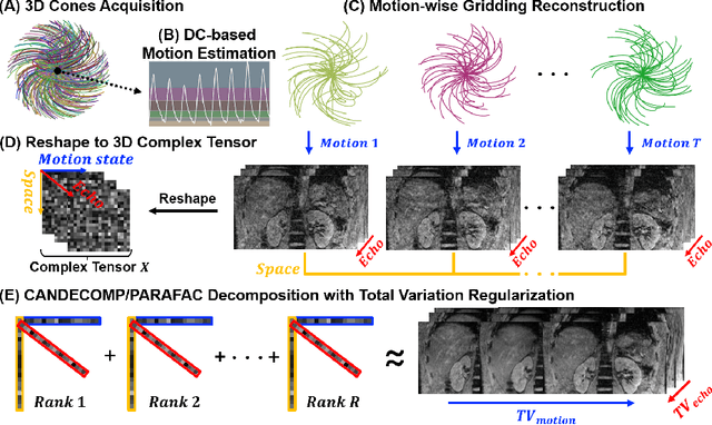 Figure 1 for A Novel Low-Rank Tensor Method for Undersampling Artifact Removal in Respiratory Motion-Resolved Multi-Echo 3D Cones MRI
