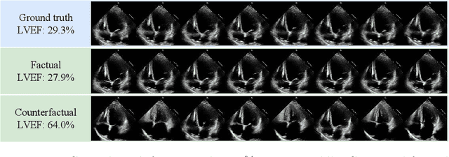 Figure 3 for Feature-Conditioned Cascaded Video Diffusion Models for Precise Echocardiogram Synthesis