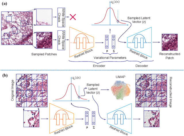 Figure 1 for Clinically Relevant Latent Space Embedding of Cancer Histopathology Slides through Variational Autoencoder Based Image Compression