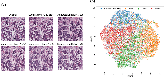 Figure 4 for Clinically Relevant Latent Space Embedding of Cancer Histopathology Slides through Variational Autoencoder Based Image Compression