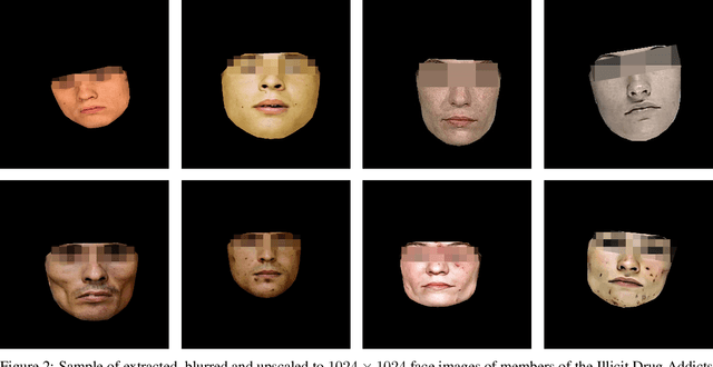 Figure 3 for Generation of artificial facial drug abuse images using Deep De-identified anonymous Dataset augmentation through Genetics Algorithm (3DG-GA)