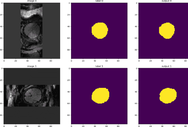 Figure 1 for Artificial Intelligence in Fetal Resting-State Functional MRI Brain Segmentation: A Comparative Analysis of 3D UNet, VNet, and HighRes-Net Models