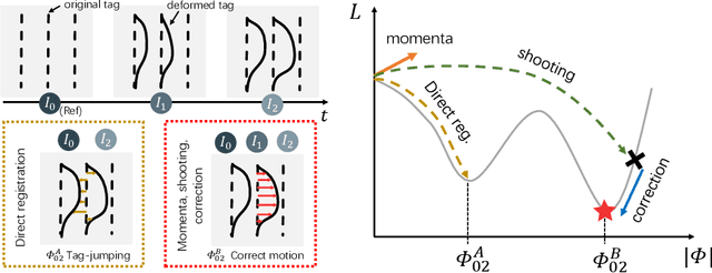 Figure 1 for MomentaMorph: Unsupervised Spatial-Temporal Registration with Momenta, Shooting, and Correction