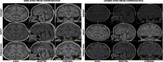 Figure 3 for Harmonization Across Imaging Locations(HAIL): One-Shot Learning for Brain MRI
