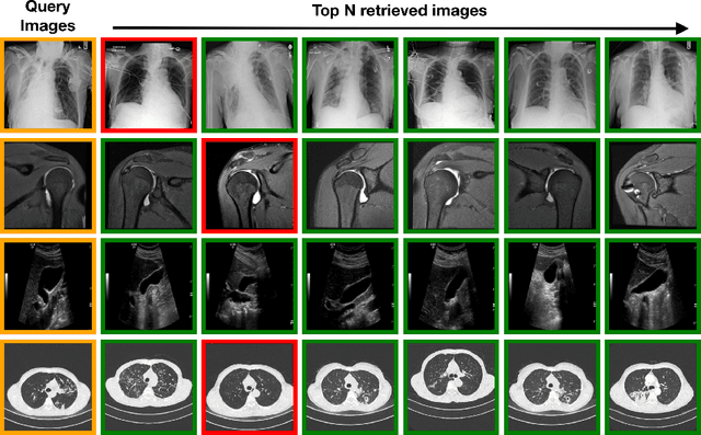 Figure 3 for Leveraging Foundation Models for Content-Based Medical Image Retrieval in Radiology