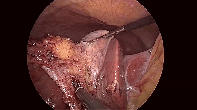 Figure 3 for Rapid and robust endoscopic content area estimation: A lean GPU-based pipeline and curated benchmark dataset