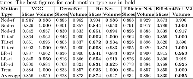 Figure 2 for Motion Artifacts Detection in Short-scan Dental CBCT Reconstructions