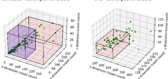 Figure 4 for Anisotropic Hybrid Networks for liver tumor segmentation with uncertainty quantification