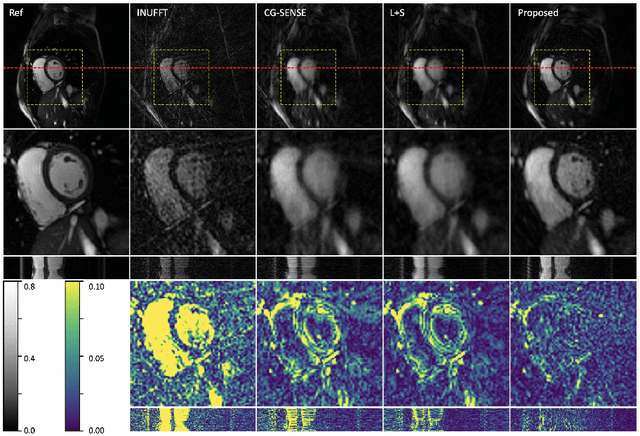 Figure 4 for Neural Implicit k-Space for Binning-free Non-Cartesian Cardiac MR Imaging