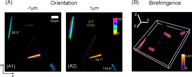 Figure 4 for Tensorial tomographic Fourier Ptychography with applications to muscle tissue imaging