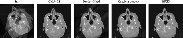 Figure 3 for Optimizing CT Scan Geometries With and Without Gradients