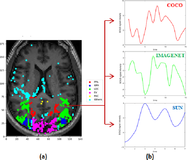 Figure 4 for Investigating the changes in BOLD responses during viewing of images with varied complexity: An fMRI time-series based analysis on human vision