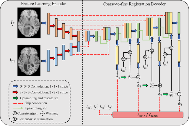 Figure 1 for Brain Tumor Sequence Registration with Non-iterative Coarse-to-fine Networks and Dual Deep Supervision