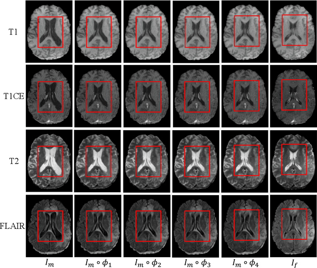 Figure 3 for Brain Tumor Sequence Registration with Non-iterative Coarse-to-fine Networks and Dual Deep Supervision