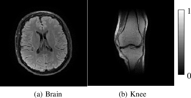 Figure 1 for A Complex Quasi-Newton Proximal Method for Image Reconstruction in Compressed Sensing MRI