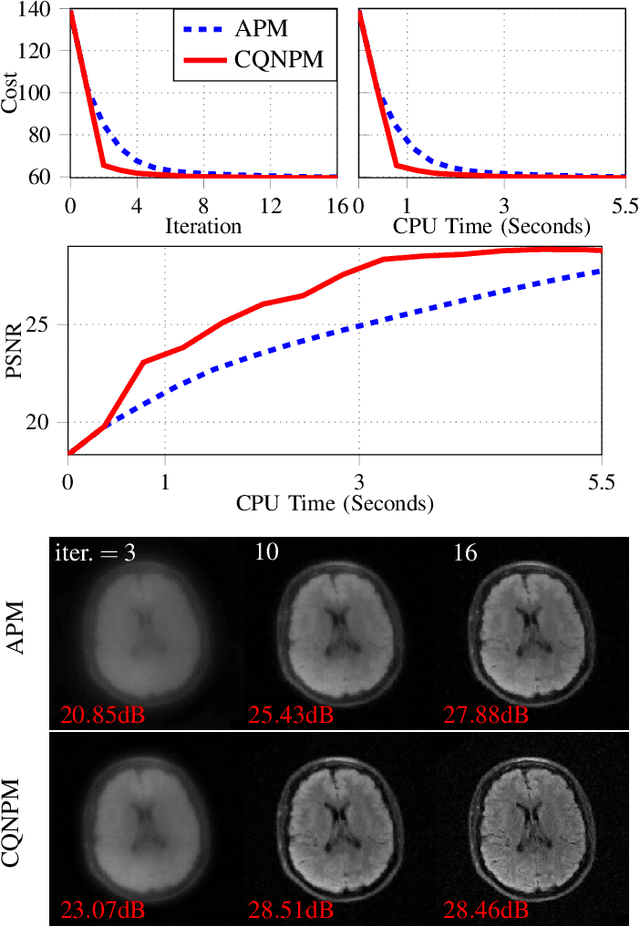 Figure 2 for A Complex Quasi-Newton Proximal Method for Image Reconstruction in Compressed Sensing MRI