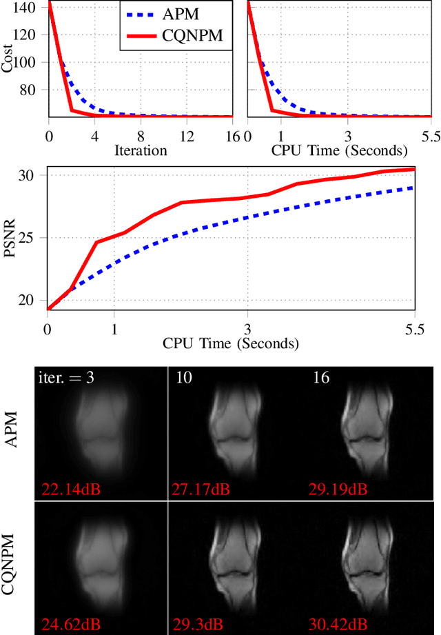 Figure 3 for A Complex Quasi-Newton Proximal Method for Image Reconstruction in Compressed Sensing MRI