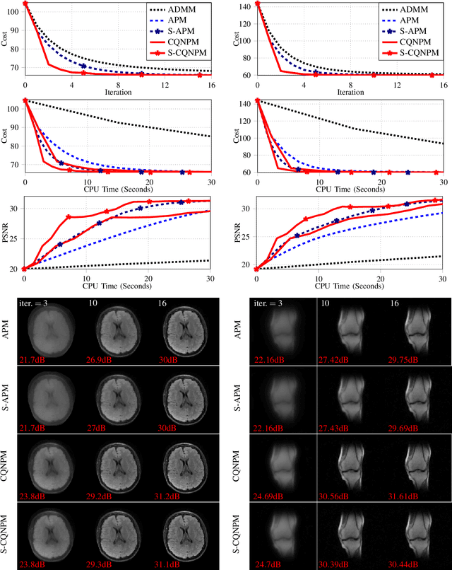 Figure 4 for A Complex Quasi-Newton Proximal Method for Image Reconstruction in Compressed Sensing MRI