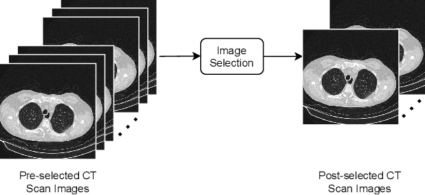 Figure 1 for COVID-19 detection from pulmonary CT scans using a novel EfficientNet with attention mechanism