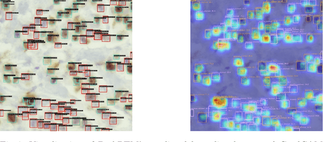 Figure 3 for PathRTM: Real-time prediction of KI-67 and tumor-infiltrated lymphocytes