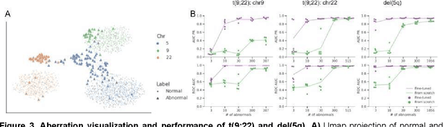 Figure 4 for Automated Deep Aberration Detection from Chromosome Karyotype Images