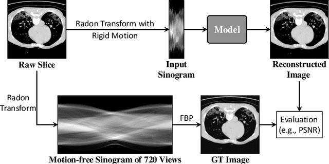 Figure 3 for Joint Rigid Motion Correction and Sparse-View CT via Self-Calibrating Neural Field