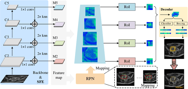 Figure 1 for MM-SFENet: Multi-scale Multi-task Localization and Classification of Bladder Cancer in MRI with Spatial Feature Encoder Network