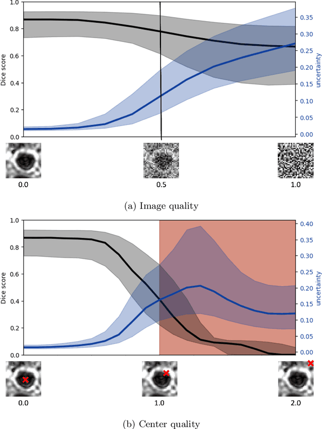 Figure 3 for Uncertainty-based quality assurance of carotid artery wall segmentation in black-blood MRI