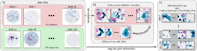 Figure 1 for Self-Supervised Learning-Based Cervical Cytology Diagnostics in Low-Data Regime and Low-Resource Setting