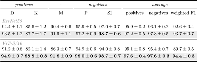 Figure 3 for Self-Supervised Learning-Based Cervical Cytology Diagnostics in Low-Data Regime and Low-Resource Setting