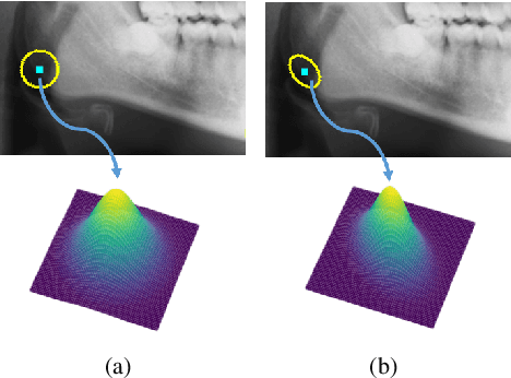 Figure 1 for Uncertainty-aware U-Net for Medical Landmark Detection