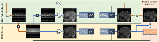 Figure 1 for Single Image Compressed Sensing MRI via a Self-Supervised Deep Denoising Approach