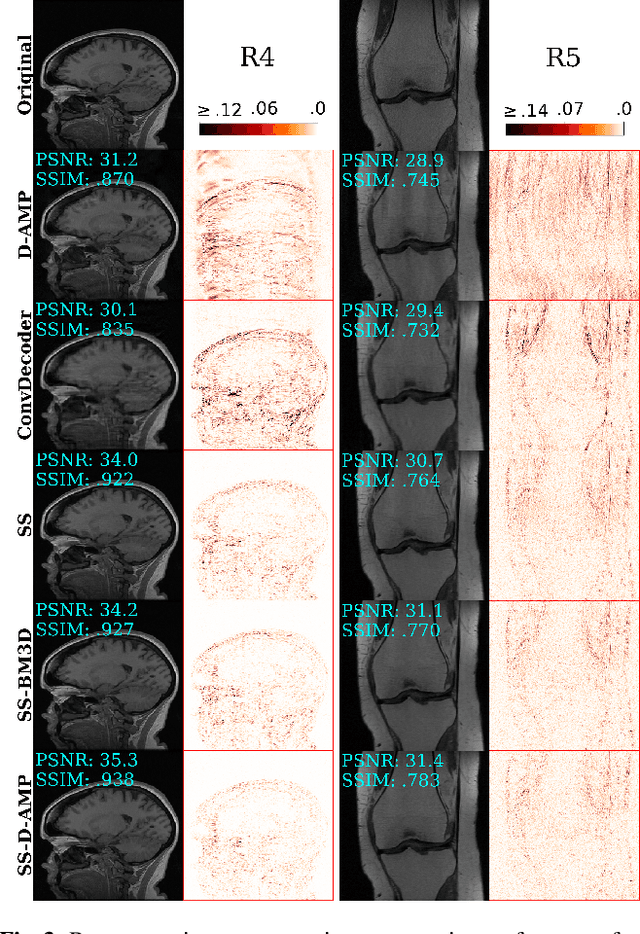 Figure 3 for Single Image Compressed Sensing MRI via a Self-Supervised Deep Denoising Approach